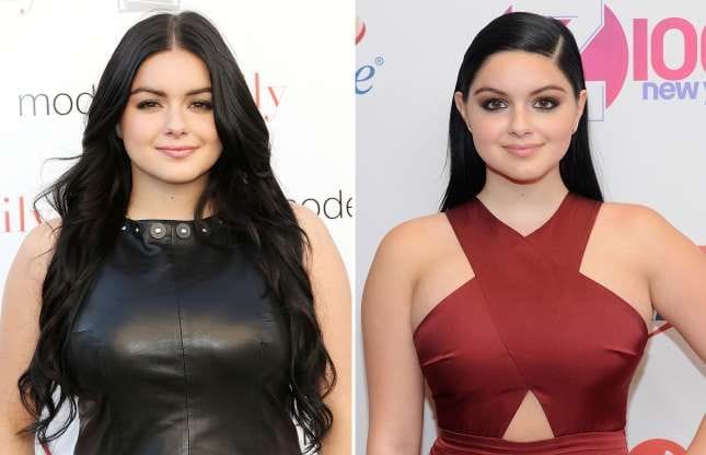 Shocking: 20 Celebrities that Have Admitted to Using Cosmetic Surgery and Injections | Spurzine