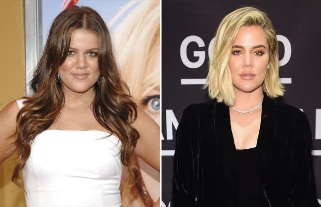 Shocking: 20 Celebrities that Have Admitted to Using Cosmetic Surgery and Injections | Spurzine