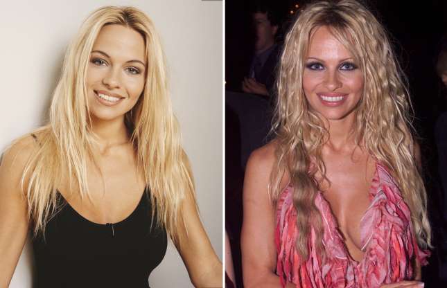 Shocking: 20 Celebrities that Have Admitted to Using Cosmetic Surgery and Injections | Spurzine