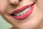 Are Dental Veneers Worth It? 7 Things You Should Consider Before Getting Them | Spurzine