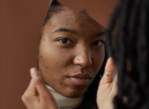 How to Make Your Face Look Gorgeous and Free From Acne Problems | Spurzine